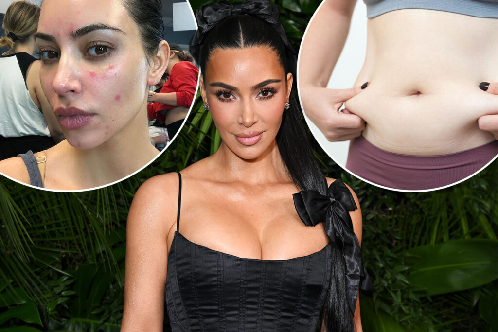JP_26_05_KIMK_PSORIASIS_COMP.jpg