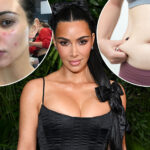 JP_26_05_KIMK_PSORIASIS_COMP.jpg