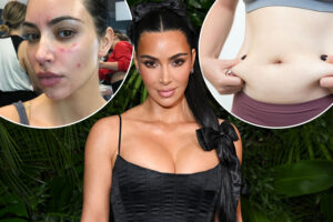 JP_26_05_KIMK_PSORIASIS_COMP.jpg